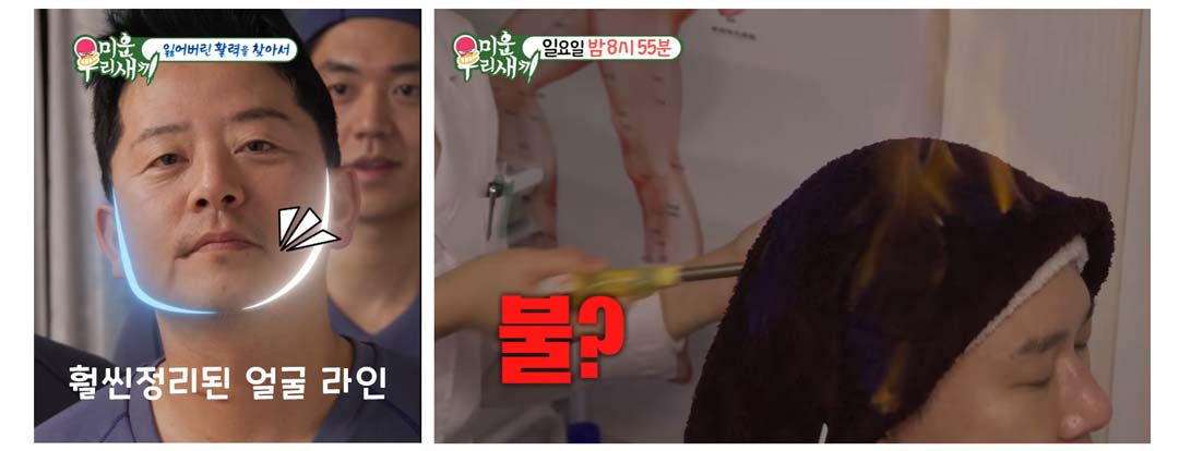 불마사지-미운-우리-새끼-시술-이상민-김준호